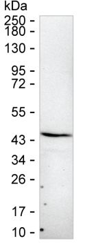 ITGB1BP2